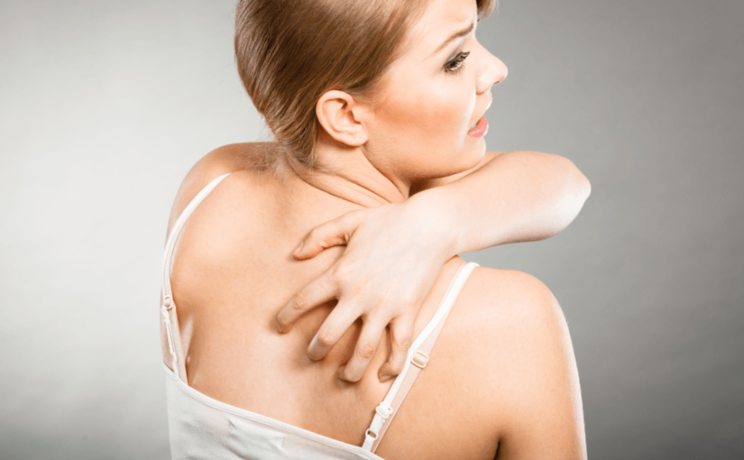 背中ニキビの原因と治し方、皮膚科での治療法をご紹介